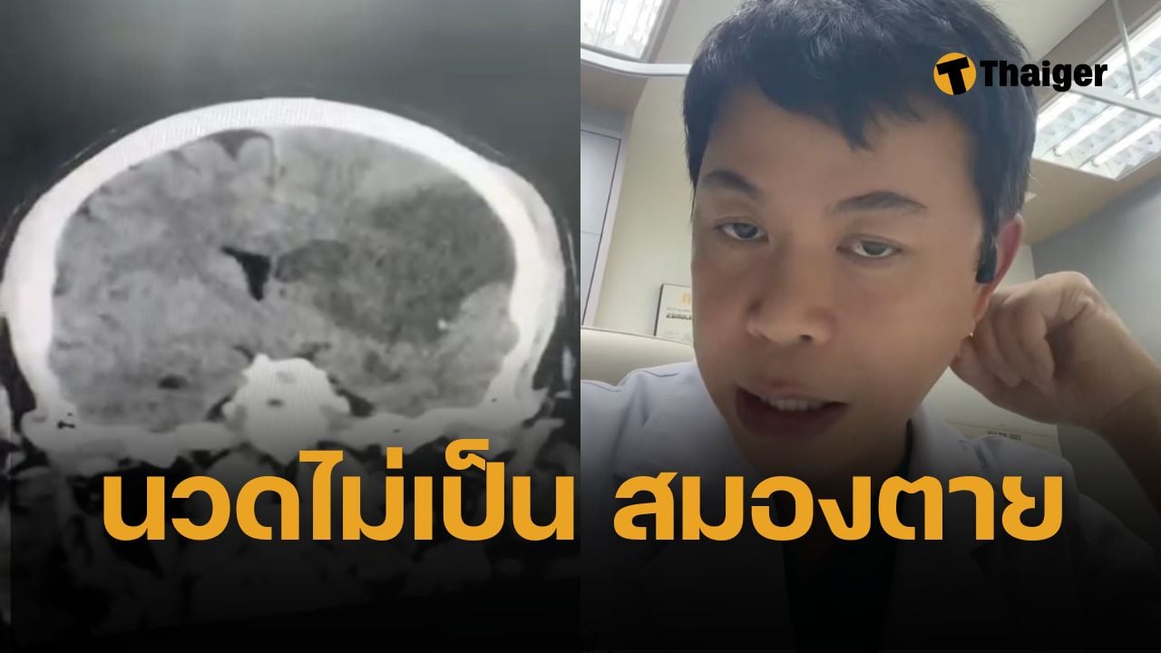 อย่าไว้ใจให้เมียนวด! หมอเตือน ชาย 54 ให้เมียนวดคอ ตื่นเช้ามา 'สมองตาย'