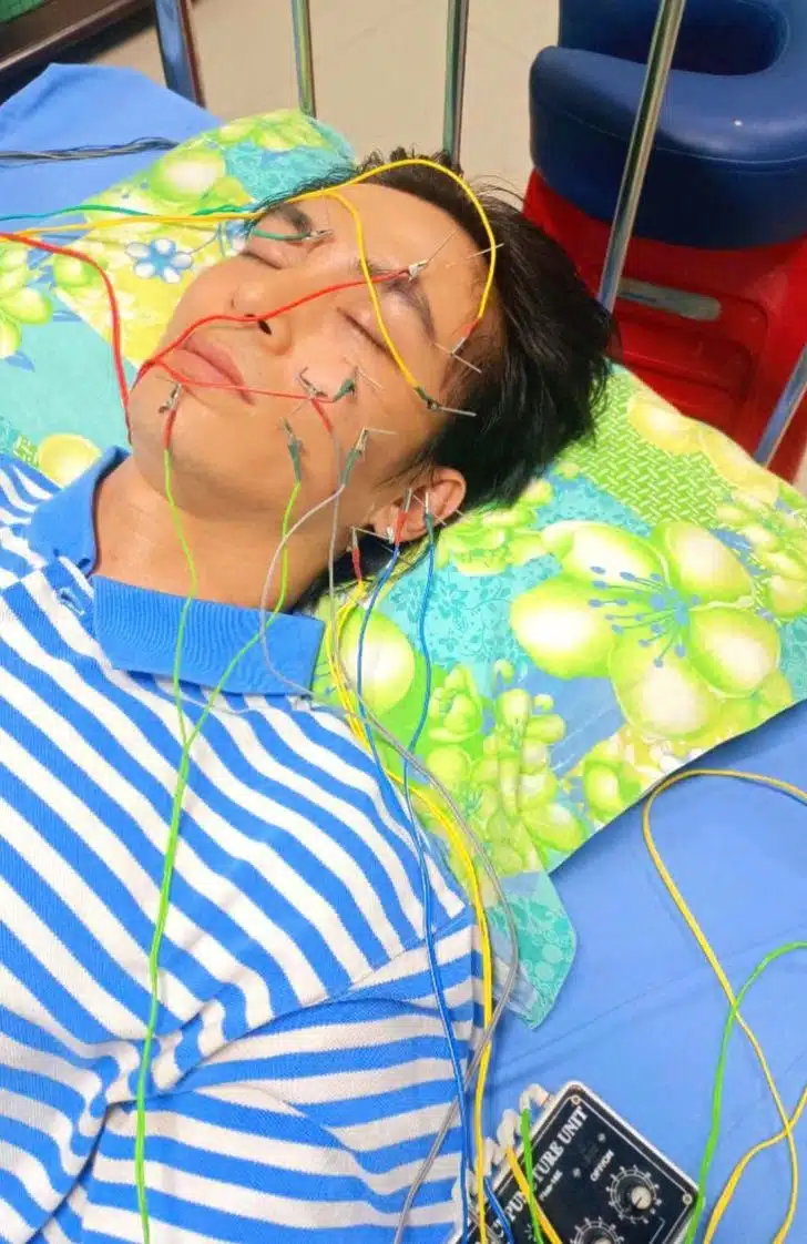 แหล่งแทง พระเอกดังเวียดนาม หน้าเบี้ยว เป็นอัมพาต เกือบหมดหล่อ เตือน 3 นิสัยวัยรุ่นชอบ ทำลายสุขภาพ