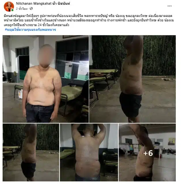 พลทหาร น้องเน รูปตอนโดนทำร้ายร่างกาย