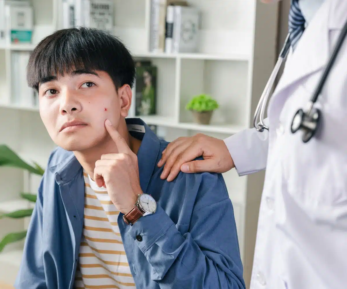 สิวไม่ใช่เรื่องน่าอาย มารู้จักวิธีรักษาสิวแบบตรงจุด