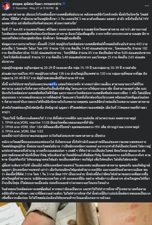 สรยุทธแชร์ข่าว ซิฟิลิส