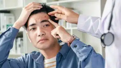 สิวขึ้นทีเหมือนโลกจะถล่ม ไม่ว่าจะเป็นสิวเม็ดใหญ่ สิวผดจิ๋วๆ หรือสิวที่มาแบบเงียบๆ แต่ทิ้งรอยไว้อย่างกับอยู่ถาวร ทุกคนเคยผ่านจุดนั้นมาแล้ว และข่าวดีคือ "สิวไม่ใช่จุดจบของความมั่นใจ"