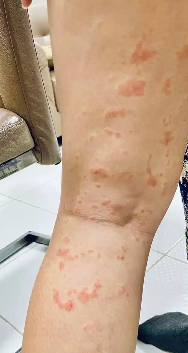 โรคร้ายระบาดหนัก