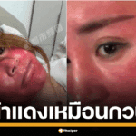 หญิงจีน ไม่ล้างเครื่องสำอาง หน้าแดง