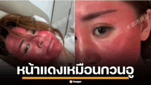 หญิงจีน ไม่ล้างเครื่องสำอาง หน้าแดง