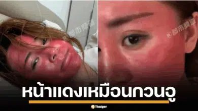 หญิงจีน ไม่ล้างเครื่องสำอาง หน้าแดง