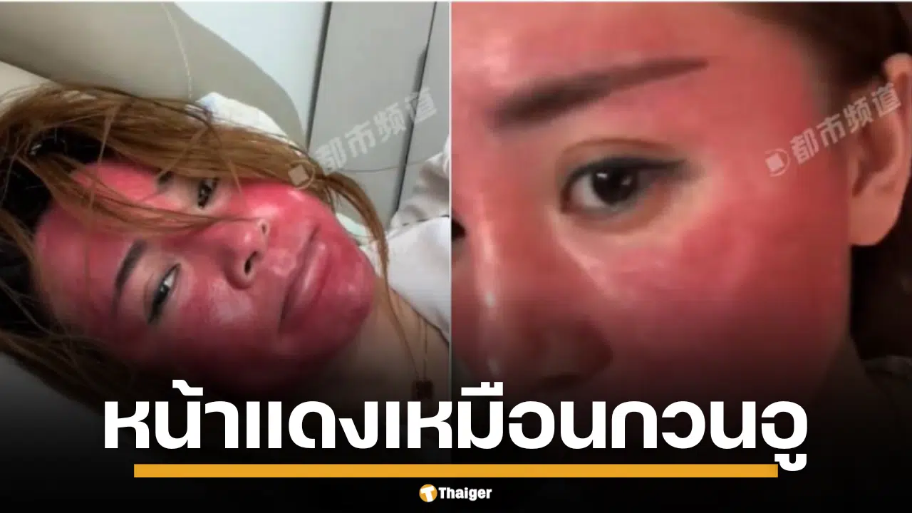 หญิงจีน ไม่ล้างเครื่องสำอาง หน้าแดง