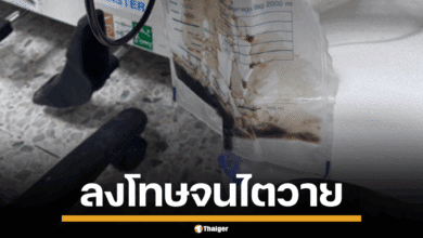 อุทาหรณ์ ครูสั่งลงโทษเด็ก ลุกนั่ง 200 ครั้ง จนไตวาย ปัสสาวะเป็นสีโค้ก