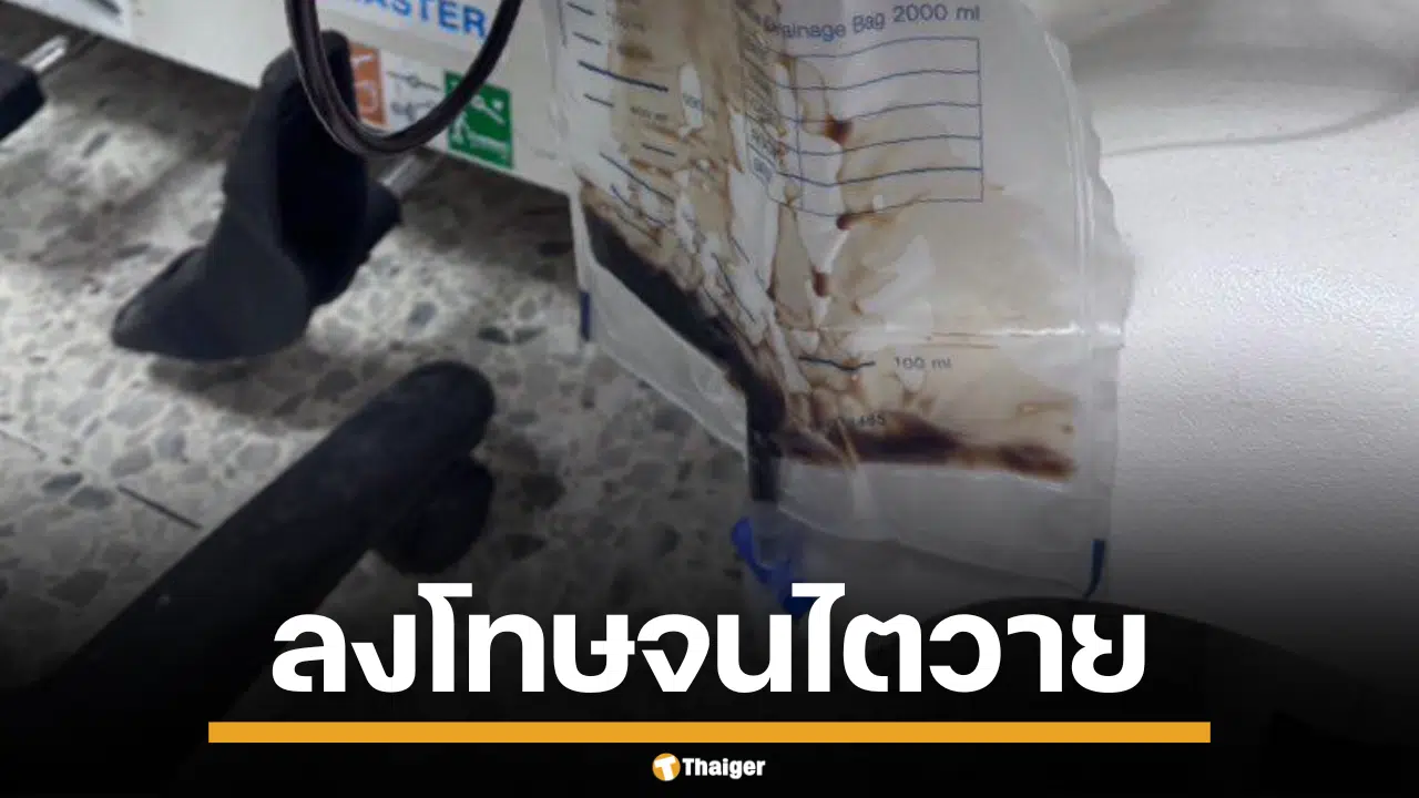 อุทาหรณ์ ครูสั่งลงโทษเด็ก ลุกนั่ง 200 ครั้ง จนไตวาย ปัสสาวะเป็นสีโค้ก
