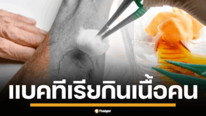 แบคทีเรียกินเนื้อคน คืออะไร ติดจาก ดิน-น้ำ-ทะเล เข้าแผลลามถึงตาย แนะวิธีป้องกัน สังเกตอาการด่วนคนไทยกลุ่มไหนเสี่ยงบ้าง