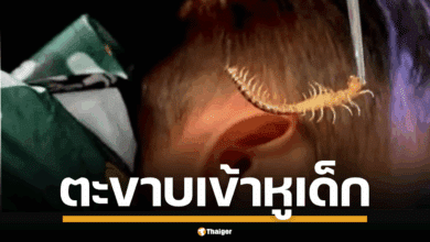 ตะขาบมุดหูลูกน้อย ซ่อนในเสื้อกันฝน แม่โพสต์เตือนภัยหน้าฝน ชาวเน็ตแห่แชร์ประสบการณ์สยอง-สงสารเด็กจับใจ