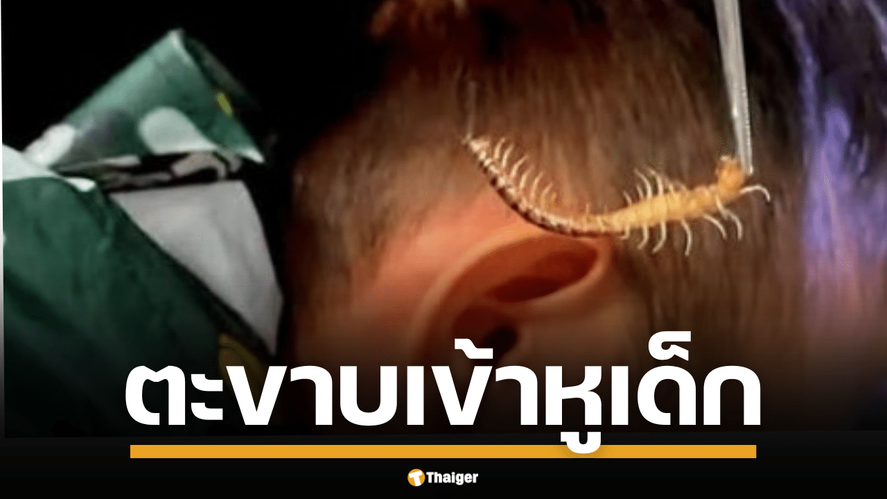 ตะขาบมุดหูลูกน้อย ซ่อนในเสื้อกันฝน แม่โพสต์เตือนภัยหน้าฝน ชาวเน็ตแห่แชร์ประสบการณ์สยอง-สงสารเด็กจับใจ