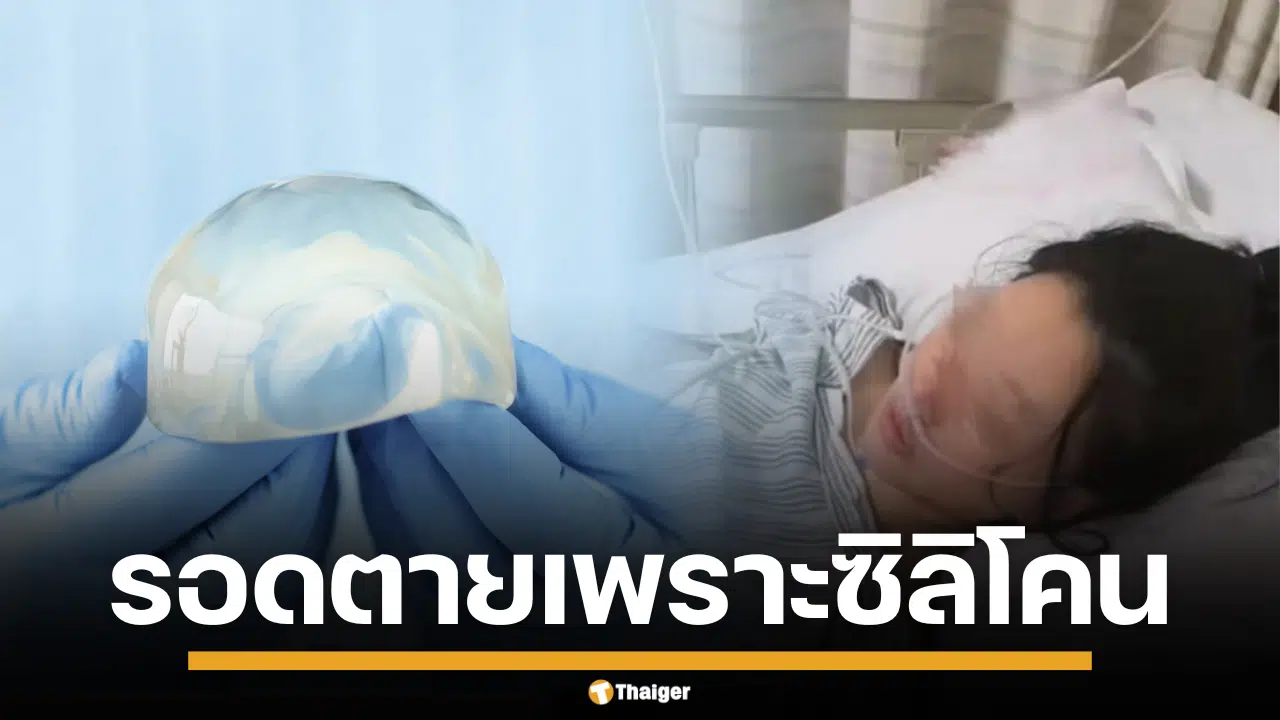 เหลือเชื่อ สาวจีนถูกชายแปลกหน้า จี้แทง 22 แผล รอดตายเพราะ ซิลิโคน