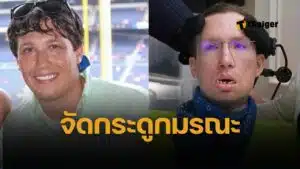 หนุ่มวัย 20 นวดจัดกระดูกคอ แค่ครั้งเดียว กลายเป็นอัมพาตทั้งร่างตลอดชีวิต ศาลสั่งจ่ายชดเชย 2.7 พันล้านบาท แต่ไม่คุ้ม ต้องนอนติดเตียงตลอดชีวิต