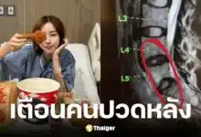 นิวเคลียร์ หรรษา แอดมิทโรงพยาบาล พบหมอนรองกระดูกเสื่อม