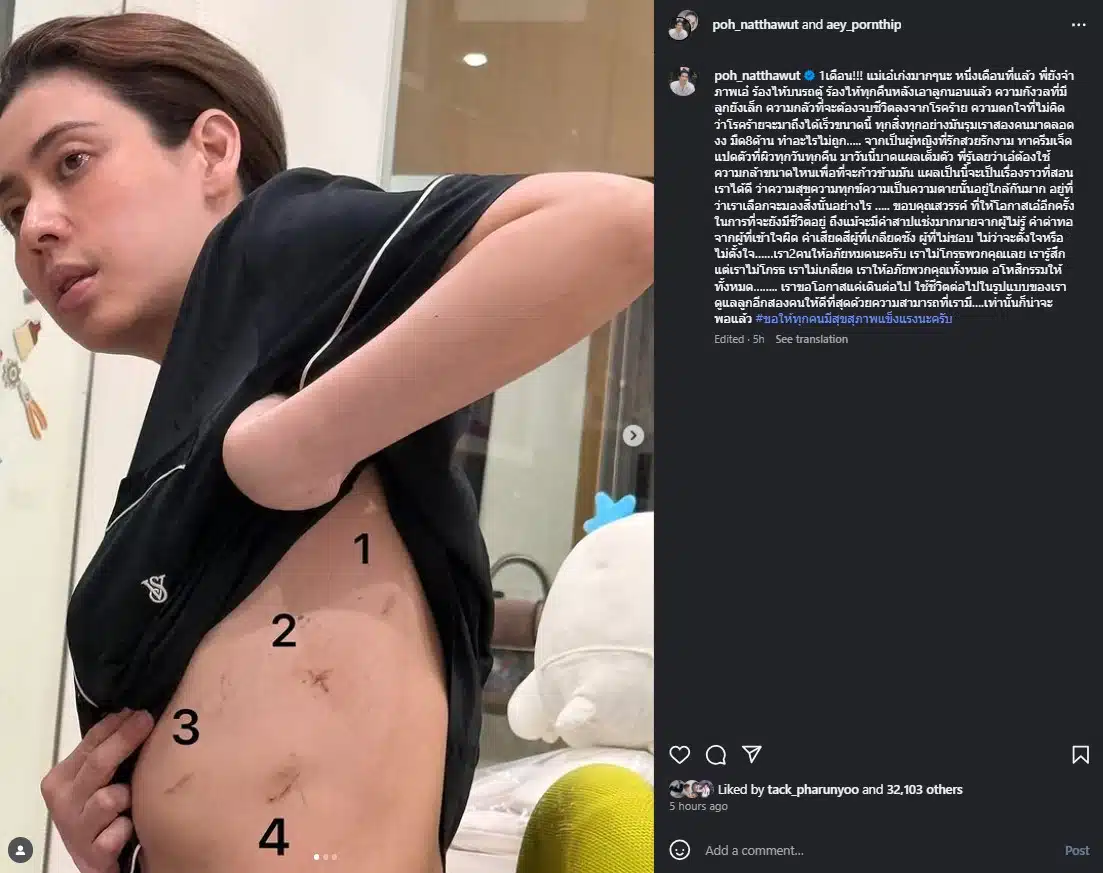 ป๋อ ณัฐวุฒิ โพสต์ภาพเอ๋ พรทิพย์ หลังผ่าตัด