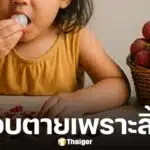 เด็กหญิง 6 ขวบ ถูกหามส่ง ICU หลังกินลิ้นจี่เกือบสิบลูก หมอเตือน ไม่ควรกินเกินจำนวน อันตรายถึงชีวิต