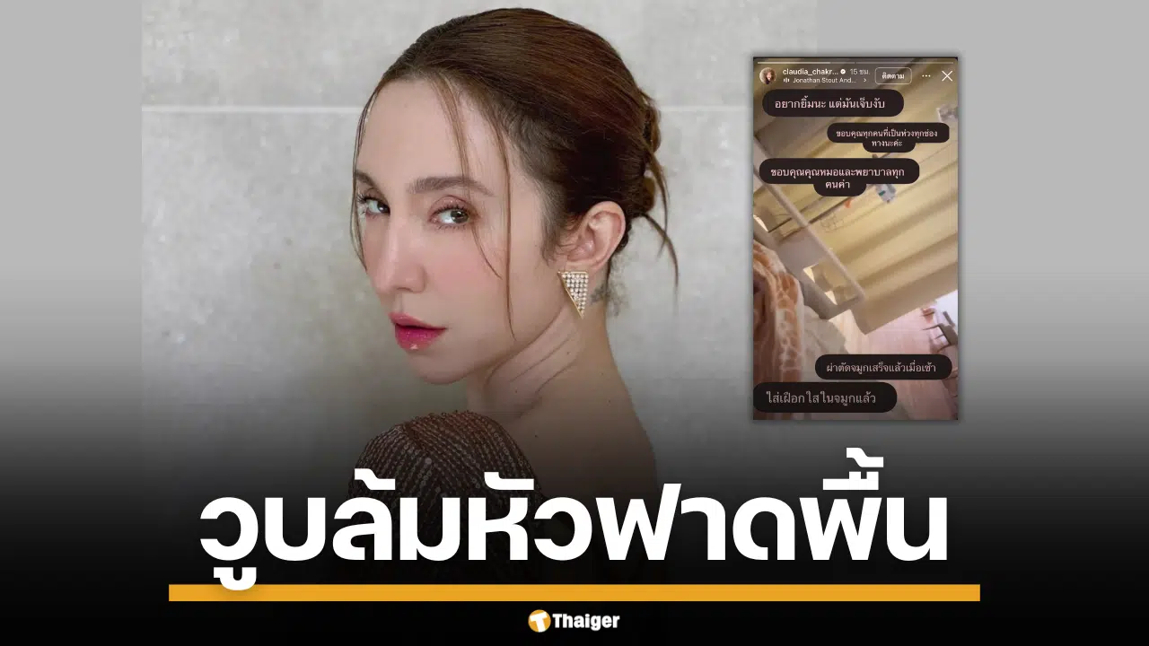 อัปเดตอาการ คลาวเดีย หลังวูบล้ม เย็บ 35 เข็ม หัวฟาดพื้น