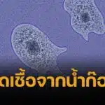 เตือนภัย หญิงใช้น้ำประปาล้างจมูก ติดเชื้ออะมีบากินสมอง ตายภายใน 1 อาทิตย์