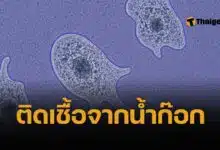 เตือนภัย หญิงใช้น้ำประปาล้างจมูก ติดเชื้ออะมีบากินสมอง ตายภายใน 1 อาทิตย์