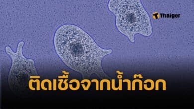 เตือนภัย หญิงใช้น้ำประปาล้างจมูก ติดเชื้ออะมีบากินสมอง ตายภายใน 1 อาทิตย์