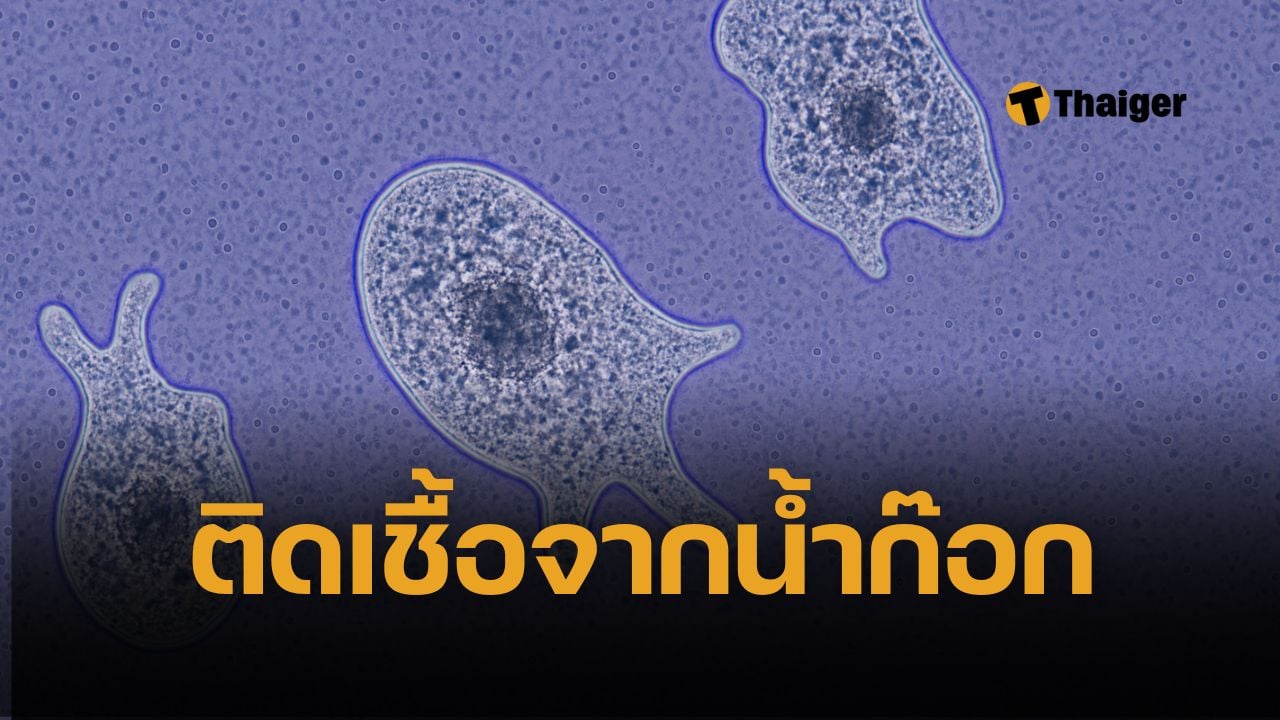 เตือนภัย หญิงใช้น้ำประปาล้างจมูก ติดเชื้ออะมีบากินสมอง ตายภายใน 1 อาทิตย์