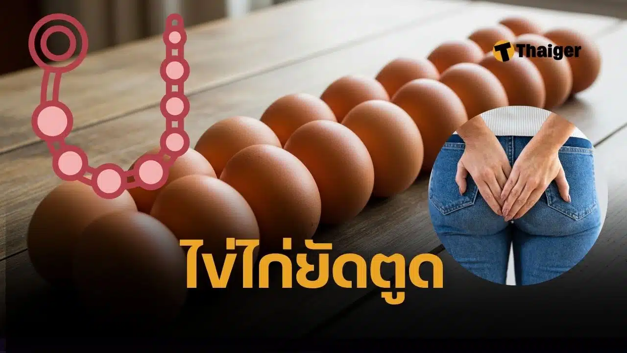 ชายดัตช์วัย 29 ปีถูกหามส่ง ICU หลังสอดไข่ต้ม 15 ฟองเข้าทวารหนัก ขณะเมายา GHB แพทย์เตือนเสี่ยงลำไส้ทะลุ ติดเชื้อรุนแรง