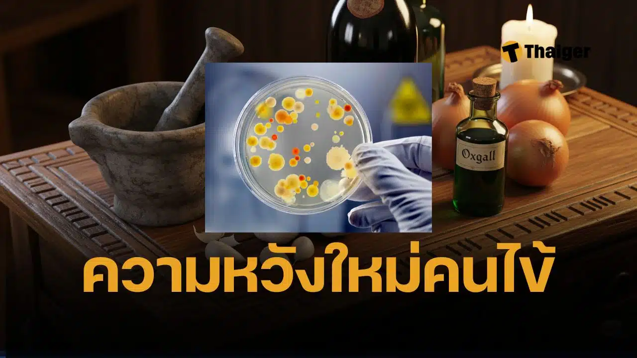 ยาโบราณพันปีพิฆาต “ซูเปอร์บัค” นักวิทย์อึ้ง สูตรตาแห้งยุคแองโกล-แซกซอน ฆ่าเชื้อดื้อยา MRSA ได้ถึง 90% ทำจากกระเทียม หัวหอม