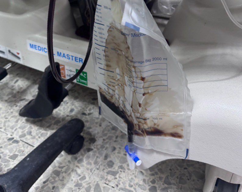 ครูสั่งลงโทษ ลุกนั่ง 200 ครั้ง เหตุนร.ส่งงานไม่ตรงเวลา จนกล้ามเนื้อสลาย-ไตวาย