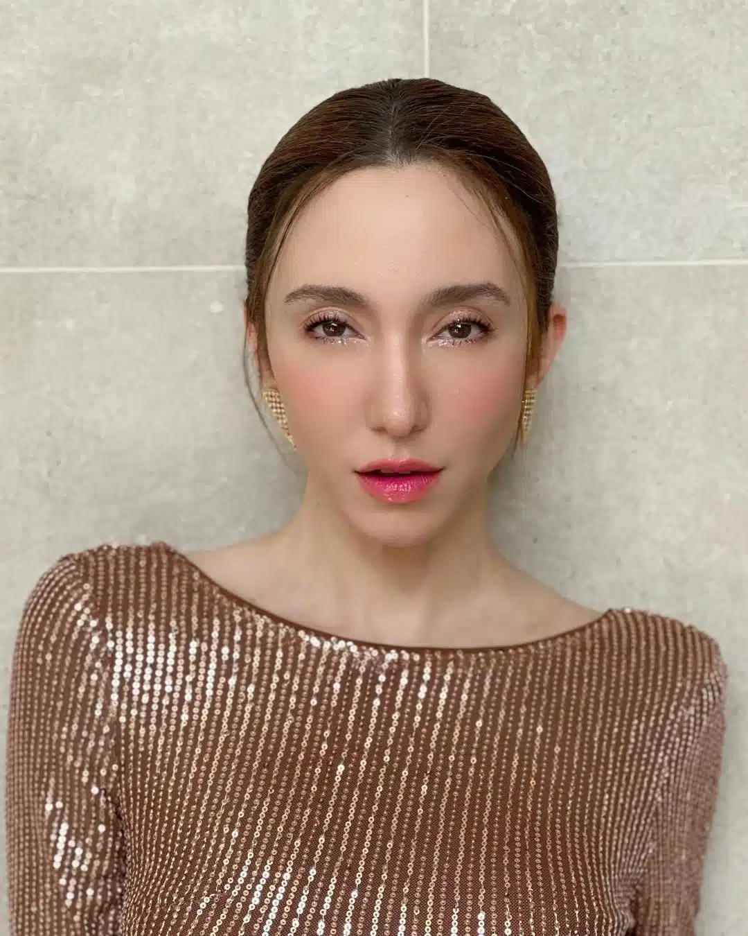 อัปเดตอาการ คลาวเดีย หลังวูบล้ม เย็บ 35 เข็ม หัวฟาดพื้น