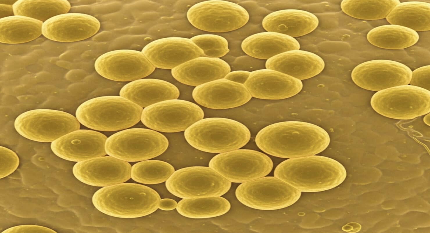 แบคทีเรีย MRSA (methicillin-resistant Staphylococcus aureus)
