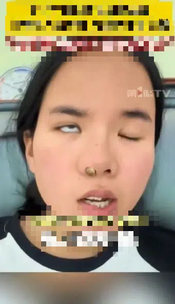 สาวจีน หน้าเบี้ยวครึ่งซีก