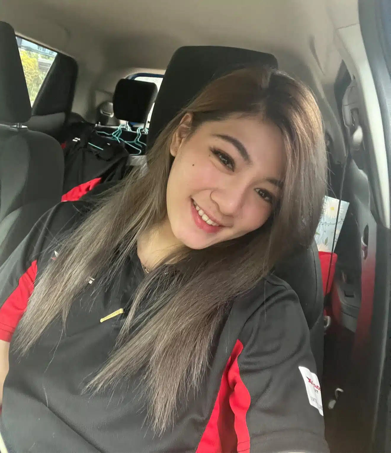 สาวแชร์ประสบการณ์ แพ้ฟิลเลอร์ เสียโฉมจนแพนิค ชาวเน็ตเห็นตรงกัน ไม่ทำก็สวย-1