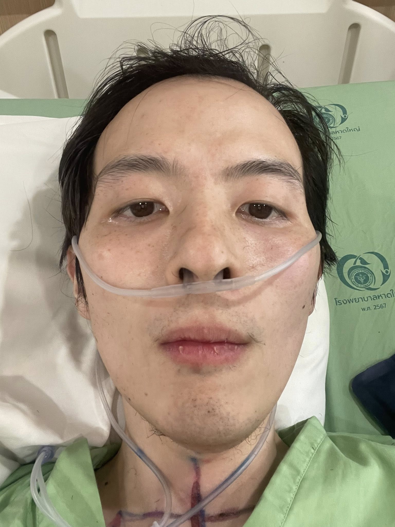 แสตมป์ นักบินหนุ่มป่วยมะเร็ง เสียชีวิตแล้ว หลังอาการทรุดหนักเพียงวันเดียว-3