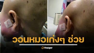 เด็กหญิงวัย 16 ป่วยมะเร็งกระดูกใบหน้ารุนแรง ครอบครัววอน แพทย์-นักวิจัยช่วยรักษา หลังรอเปลี่ยนยาแต่ยังไร้ทางออก