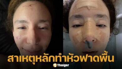 "คลาวเดีย" เปิดใจครั้งแรก สาเหตุทำวูบล้มหัวฟาดพื้น-จมูกหัก เย็บกว่า 40 เข็ม