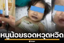 เด็ก 16 เดือน เลือดเป็นพิษตัวเขียว จากสารพิษในน้ำ ที่ใช้ปรุงอาหาร