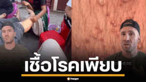 ดร.โจ วิตติงตัน แพทย์เวชศาสตร์ฉุกเฉิน วิเคราะห์เคสไวรัล ชี้สาเหตุจากมือเปล่า น้ำมันใช้ซ้ำ และโต๊ะปูนริมถนน แนะเจอแบบนี้ให้รีบกลับโรงแรม