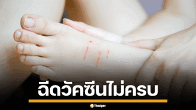 ภาพประกอบแผล ที่อาจนำไปสู่ของการเป็นบาดทะยัก