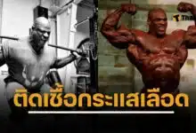 รอนนี โคลแมน แชมป์โลกเพาะกาย 8 สมัย