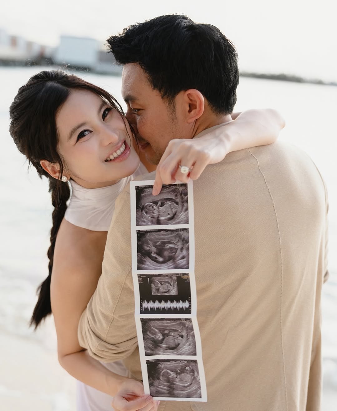 ไม่ต้องลุ้น! ออน สมฤทัย ท้องแล้ว ควงสามี หมอสอง ประกาศข่าวดีชื่นมื่น-2