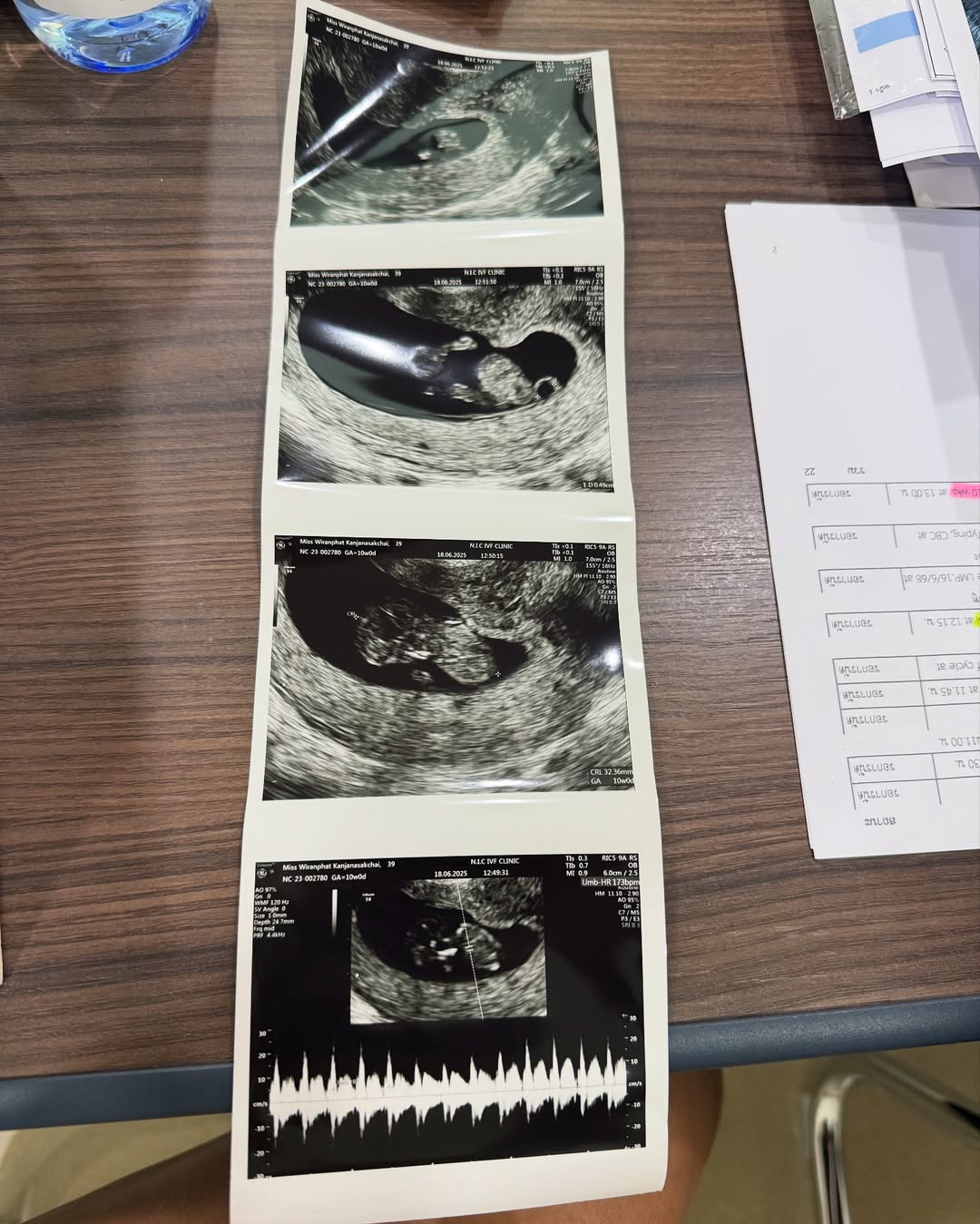 ยินดี! ปาย สิตางศุ์ ท้องแล้ว หลังเก็บไข่ 5 รอบ มีภาวะไข่แก่-ไม่ได้คุณภาพ-1