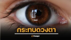 สื่ออังกฤษรายงาน นักวิทยาศาสตร์พบ “วัคซีนไฟเซอร์” อาจกระทบกระจกตา เสี่ยงปัญหาการมองเห็น แนะ ยังต้องติดตามผลระยะยาว