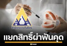 ภาพฟันคุดและสัญลักษณ์ทางการแพทย์