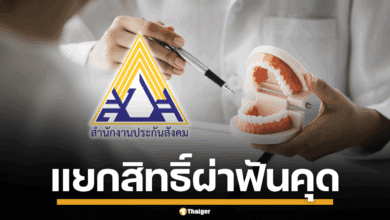 ภาพฟันคุดและสัญลักษณ์ทางการแพทย์