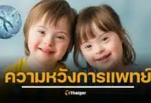 ญี่ปุ่นทำสำเร็จ ใช้เทคโนโลยี CRISPR-Cas9 กำจัดโครโมโซมเกินในเซลล์ดาวน์ซินโดรม ให้กลับมาเป็นปกติ ข่าวใหญ่วงการแพทย์ 