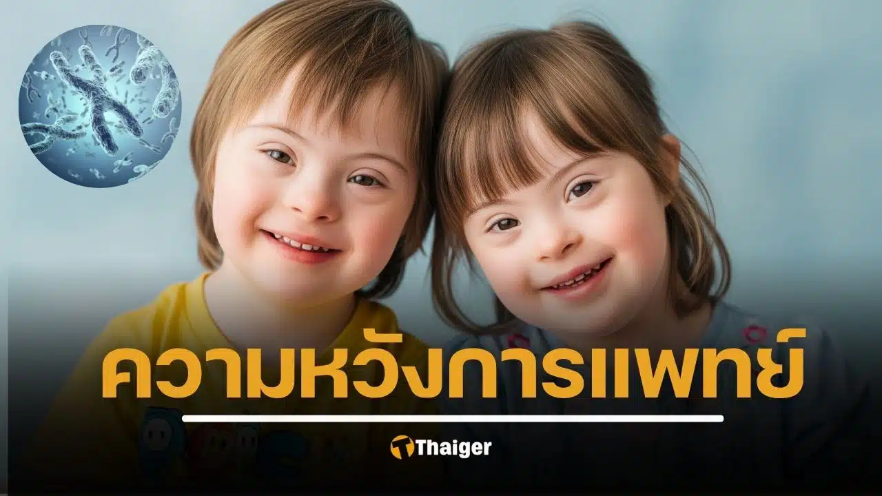 ญี่ปุ่นทำสำเร็จ ใช้เทคโนโลยี CRISPR-Cas9 กำจัดโครโมโซมเกินในเซลล์ดาวน์ซินโดรม ให้กลับมาเป็นปกติ ข่าวใหญ่วงการแพทย์