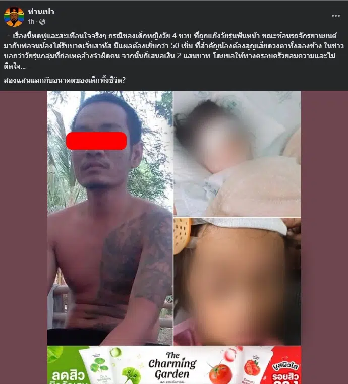 วัยรุ่นอ้างจำผิดคน ฟันเด็ก 4 ขวบ ตาบอด