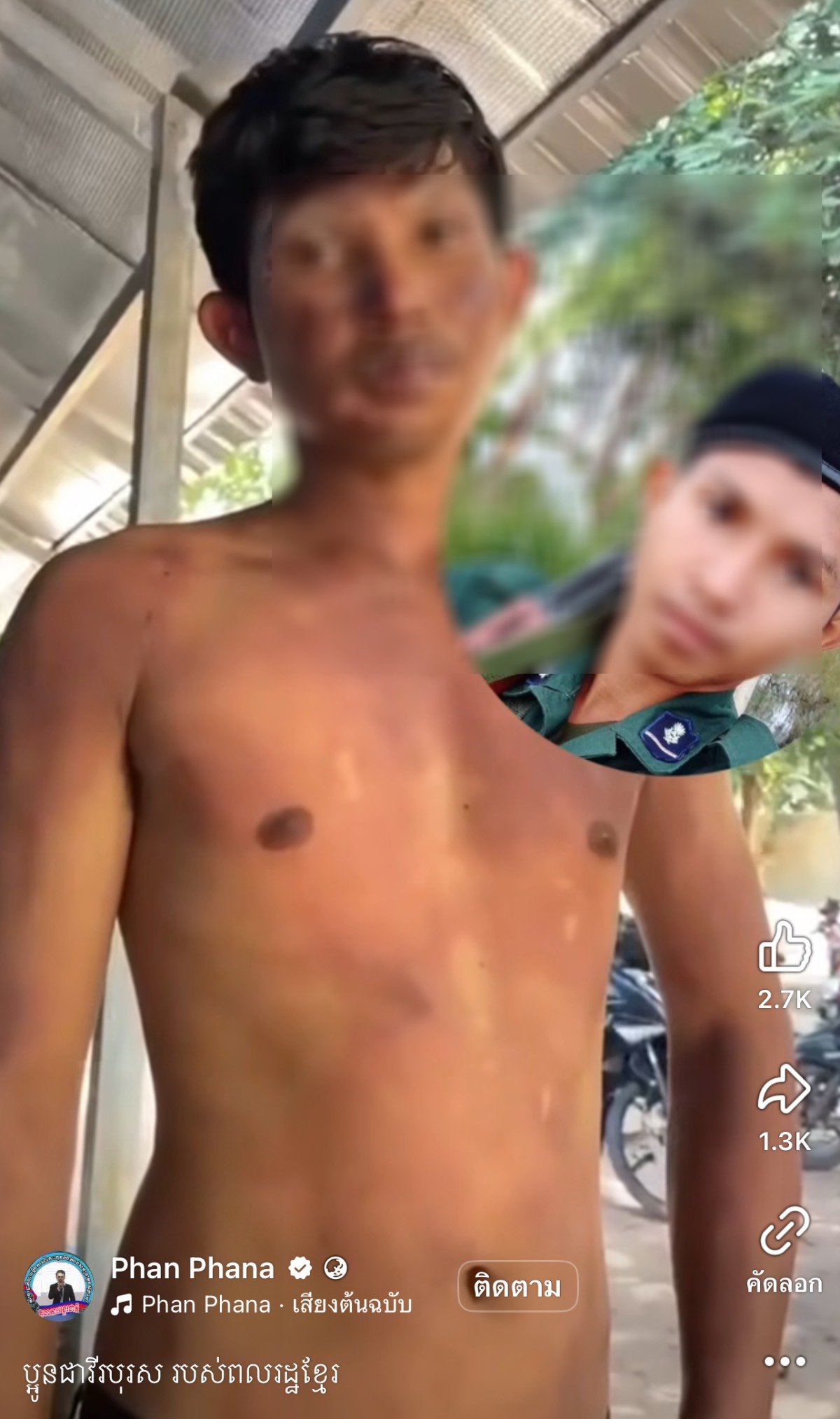 ทหารกัมพูชา สภาพหลังเหตุปะทะไทย กัมพูชา