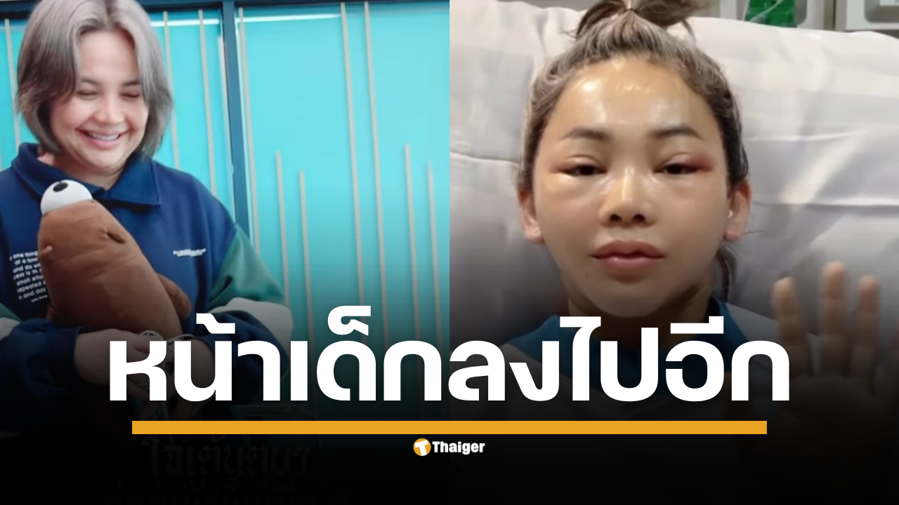 ส่องหน้าใหม่ ตั๊กแตน ชลดา หลังศัลยกรรม ลั่น "ตึงนิดหน่อย แต่เด็กลงเยอะมาก"